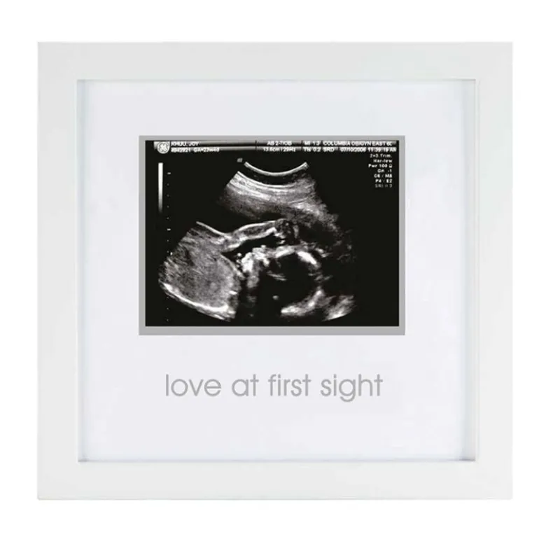 Sonogram Frame